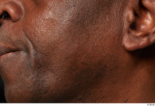 HD Face Skin Quintrell Wheeler cheek ear skin pores skin…